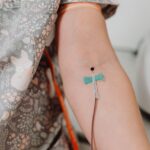 Close-up shot of an intravenous catheter inserted in a patient's arm for medical treatment.